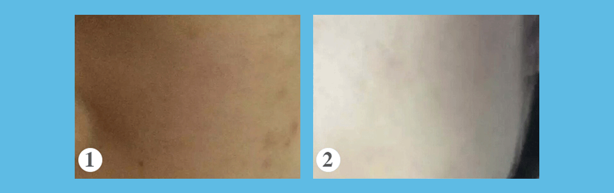 1.gif